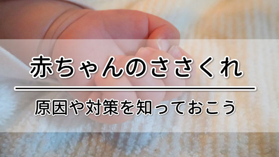 赤ちゃんの指に ささくれ を発見 原因と対策方法を知っておこう 赤ちゃんにニベアを使っても大丈夫 カサカサ乾燥肌の対策を紹介します